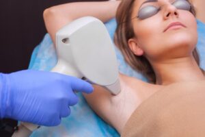 woman-having-laser-hair-removal-on-her-armpit